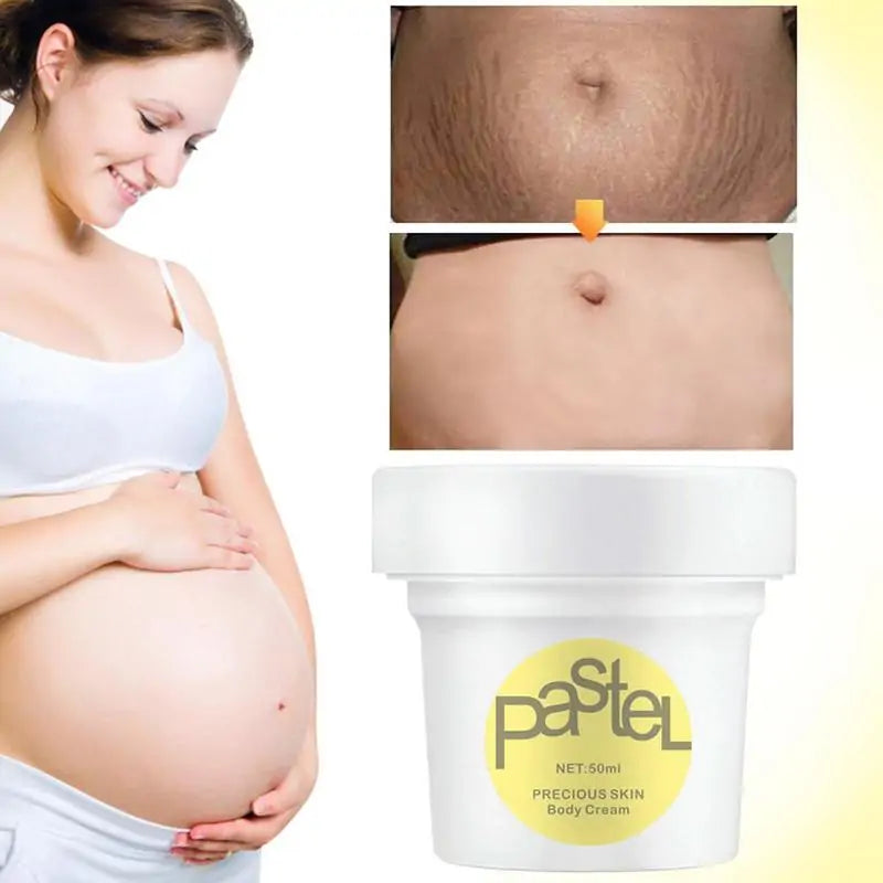 Cream for Maternity Stretch Marks