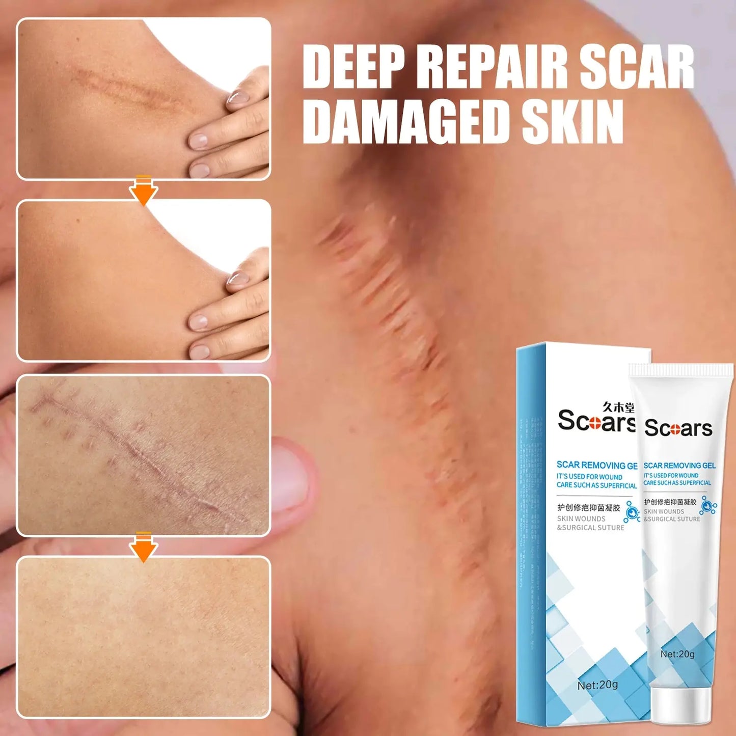 SCARS - Herbal Scar Repair Cream