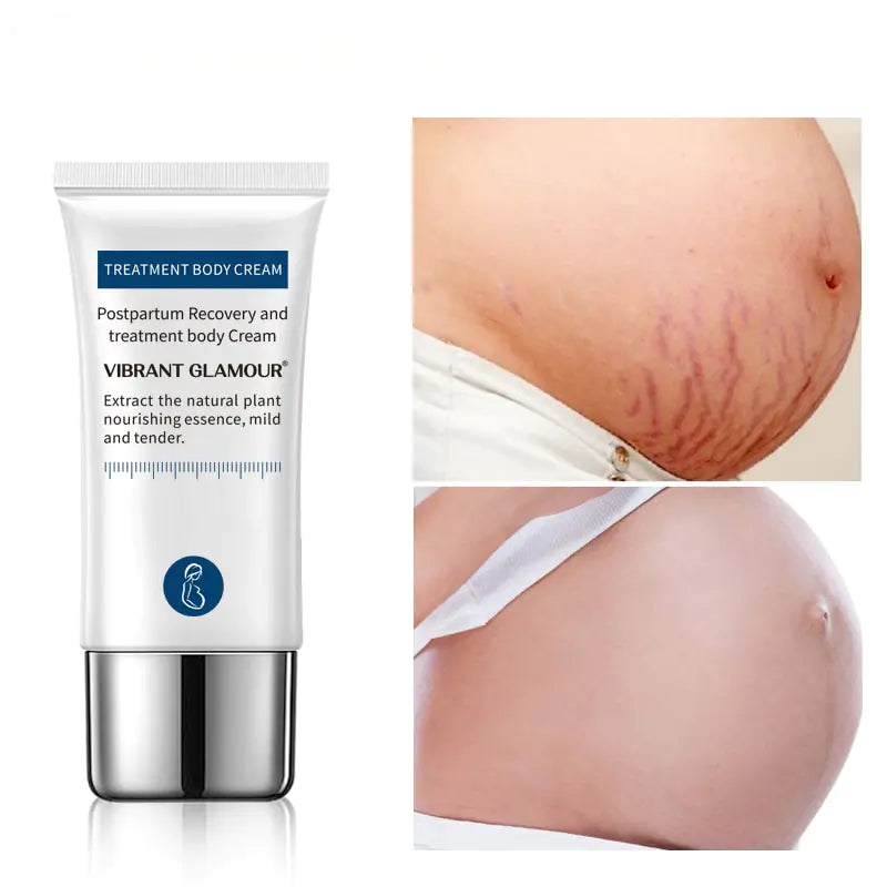 Crocodile Stretch Marks Remover Cream